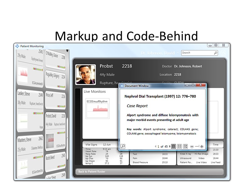 Markup and Code-Behind